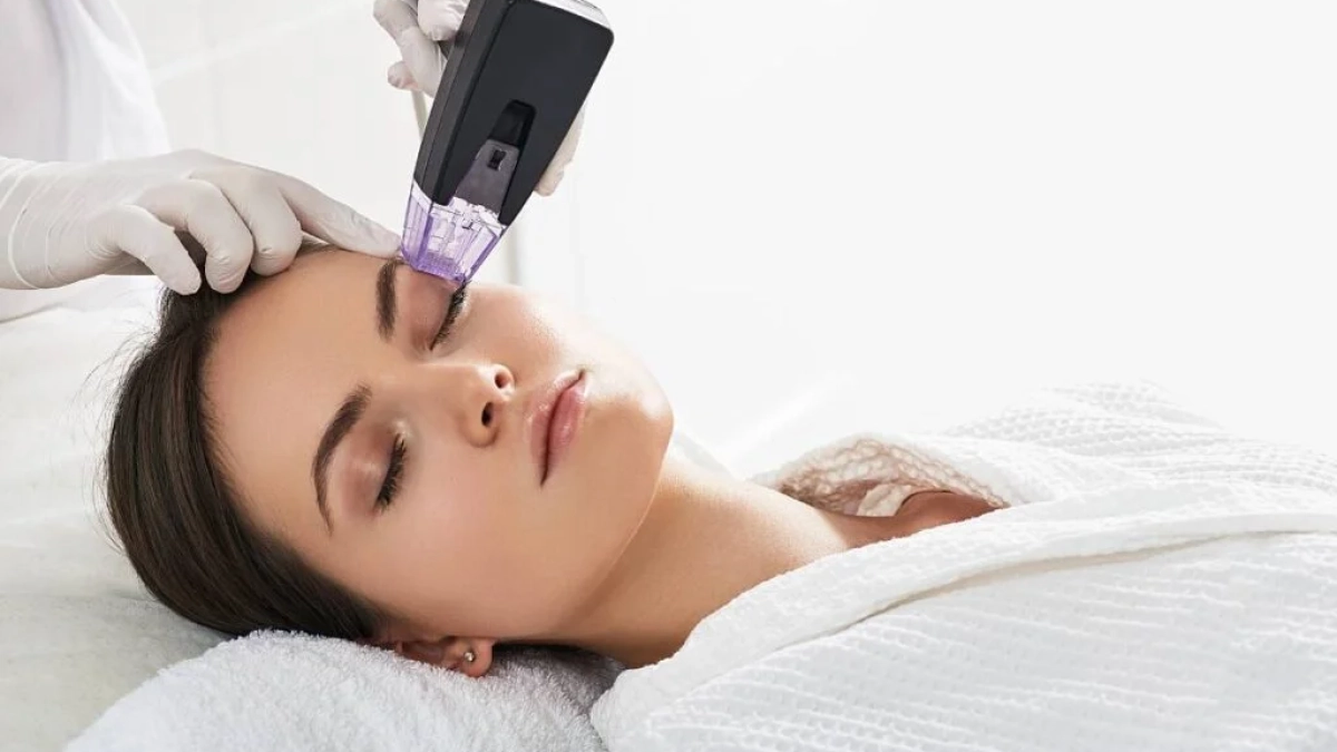 RF-Treatment